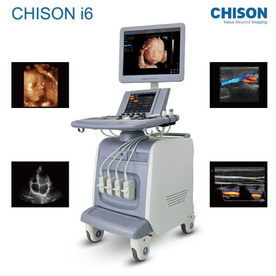 CHISON I6 2